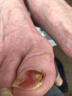 Surgery or foot image